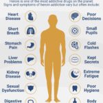 Understanding Heroin Addiction: Causes, Symptoms, and Risks